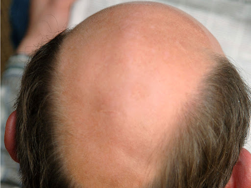 Hair Impression – Königsbrunn